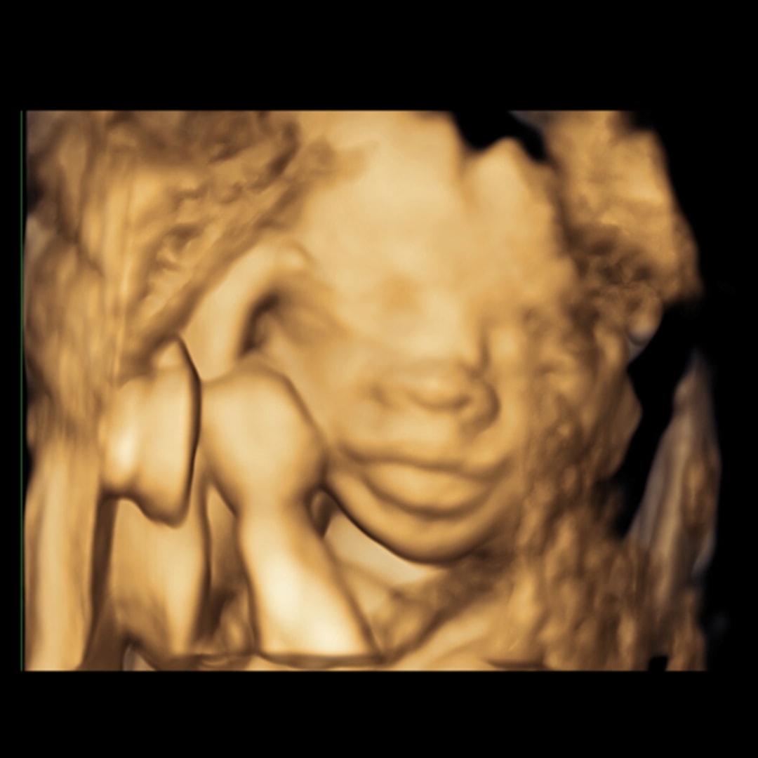 Photo shared by Teea for their Babylist baby registry.