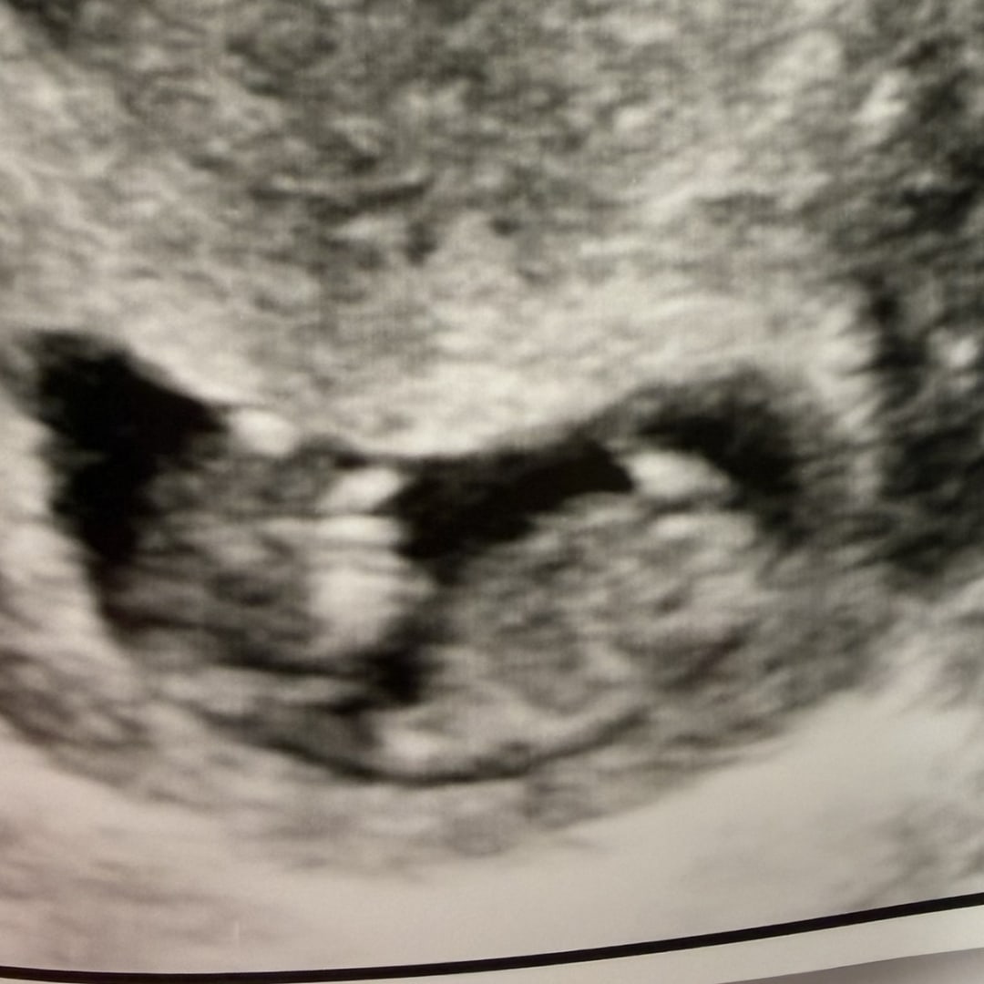 Photo shared by Alli for their Babylist baby registry.