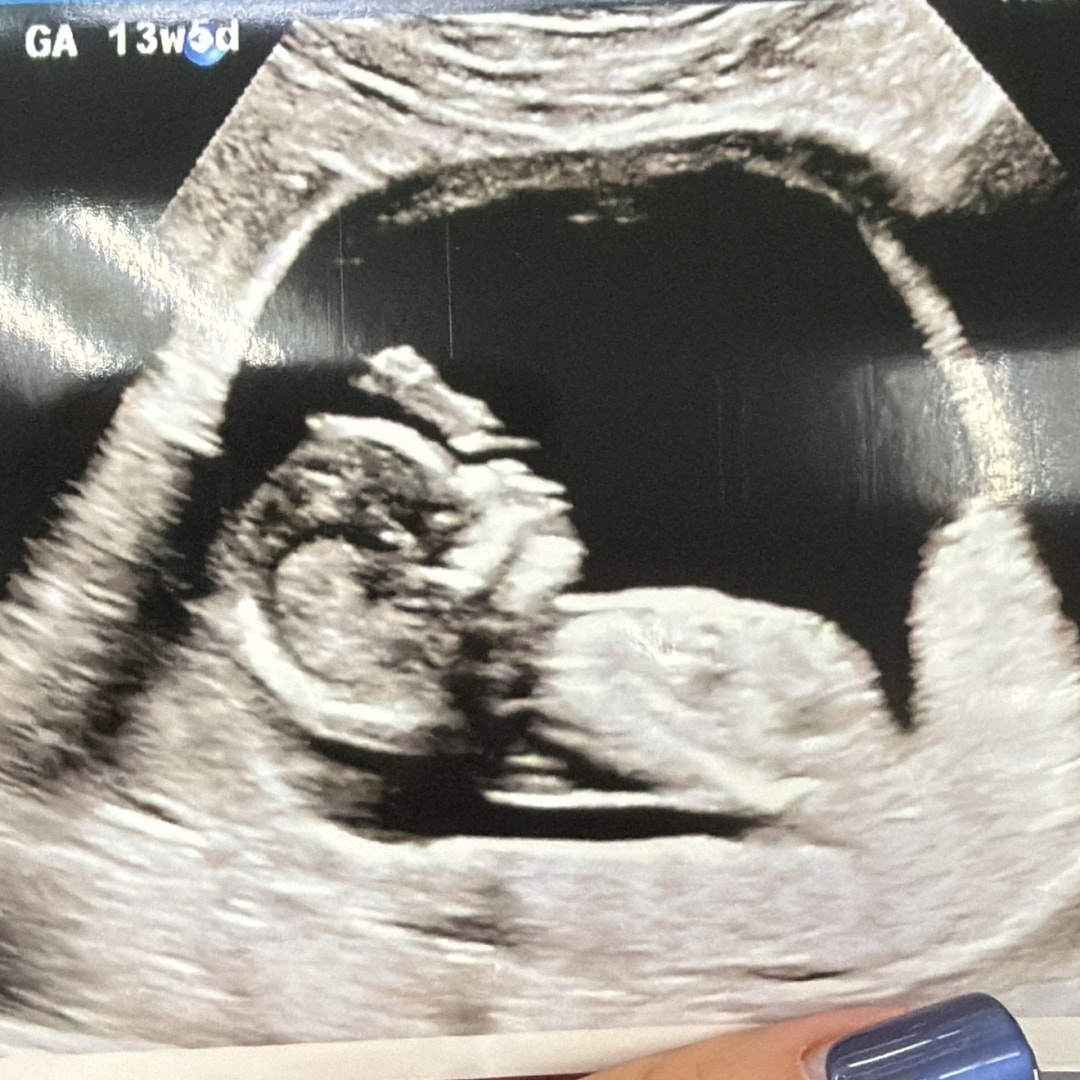 Photo shared by Nani for their Babylist baby registry.