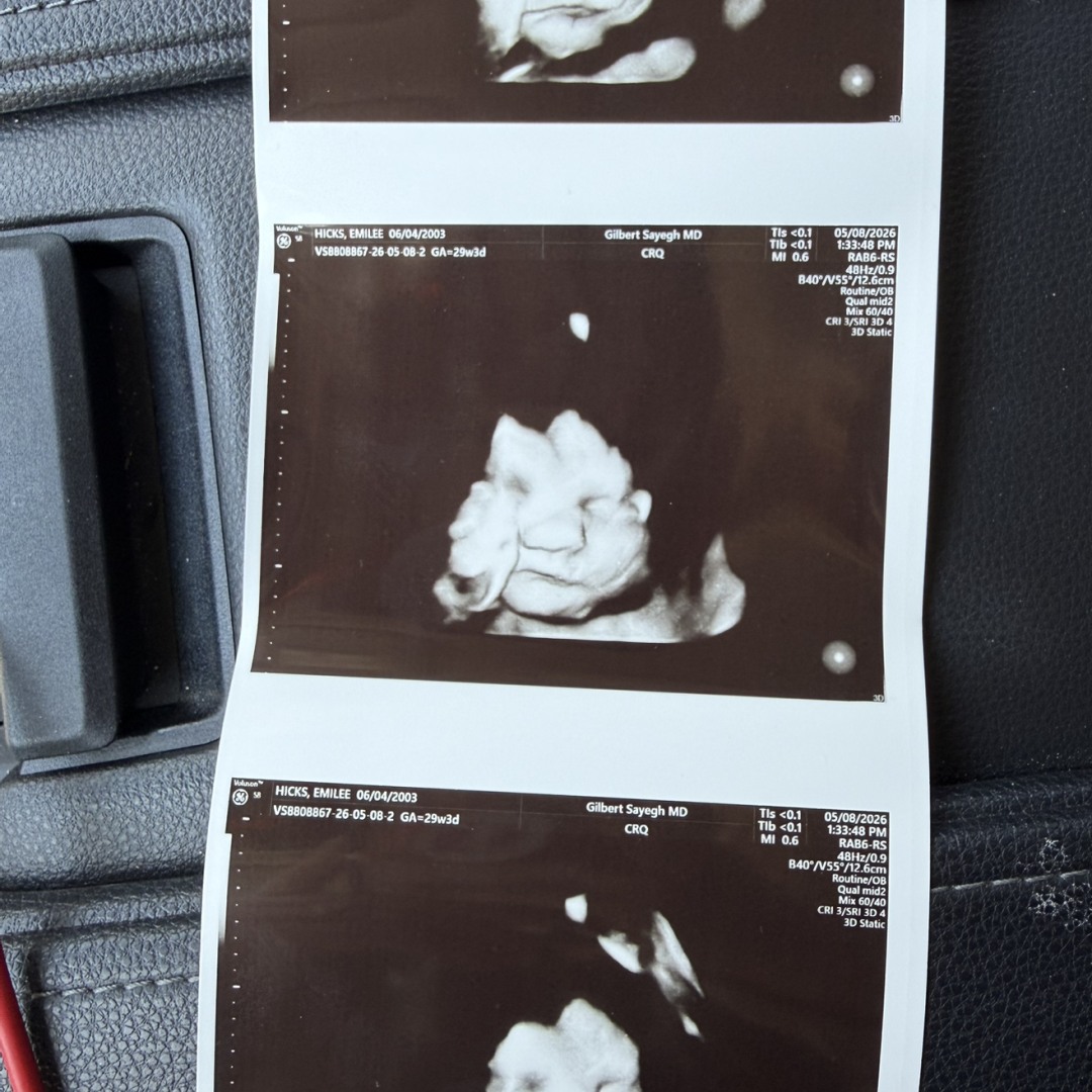 Photo shared by Emilee for their Babylist baby registry.