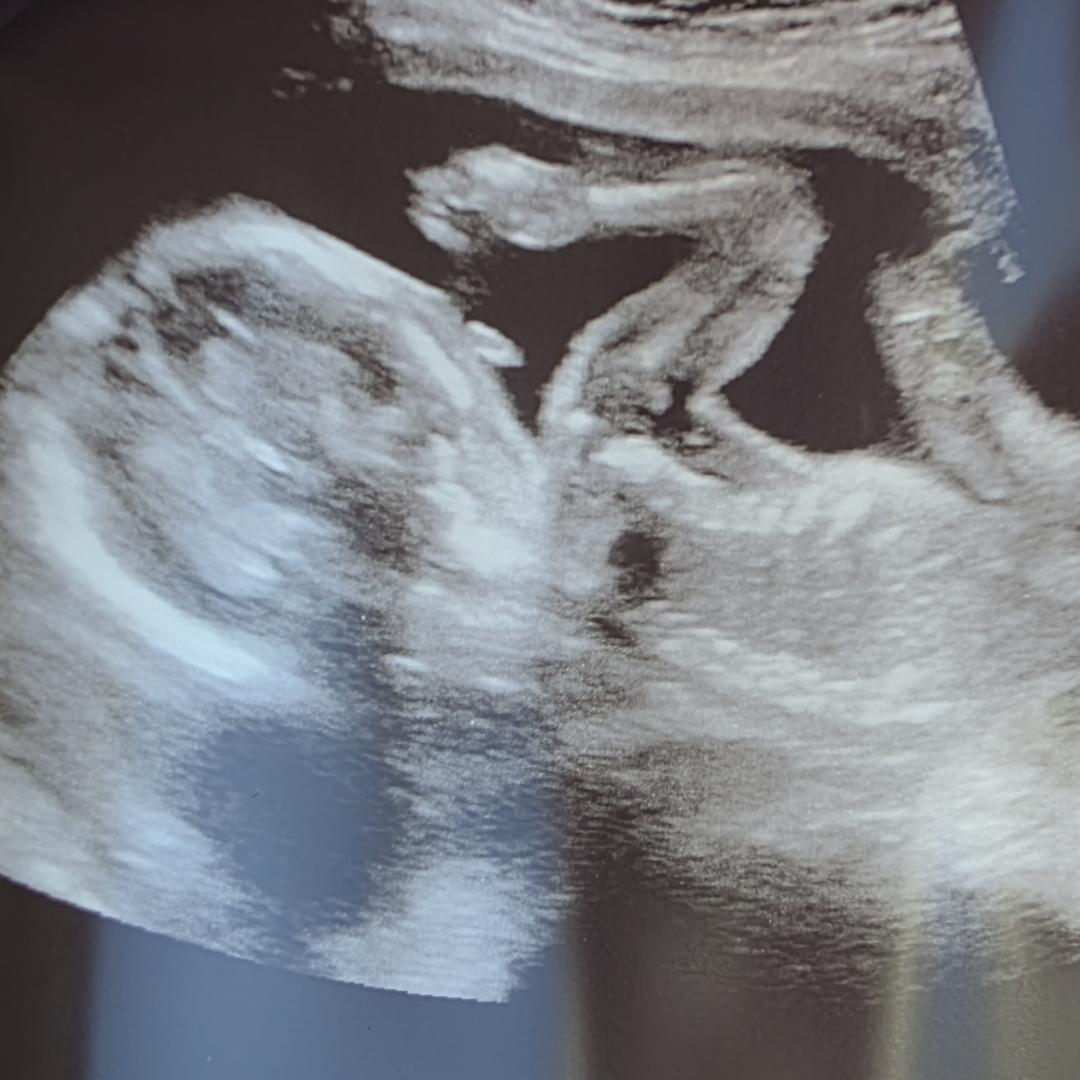 Photo shared by Samantha for their Babylist baby registry.