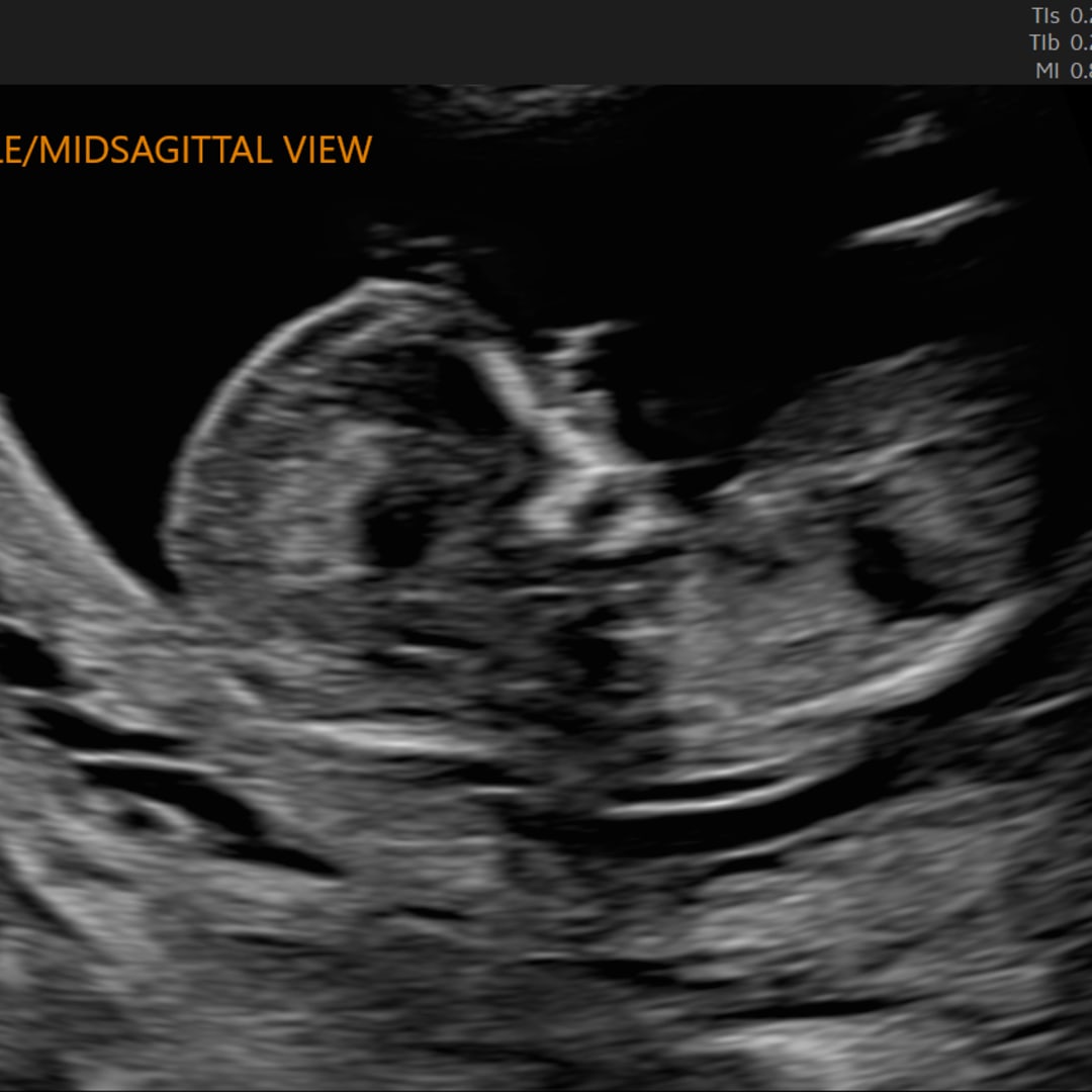 Photo shared by Jordyn for their Babylist baby registry.