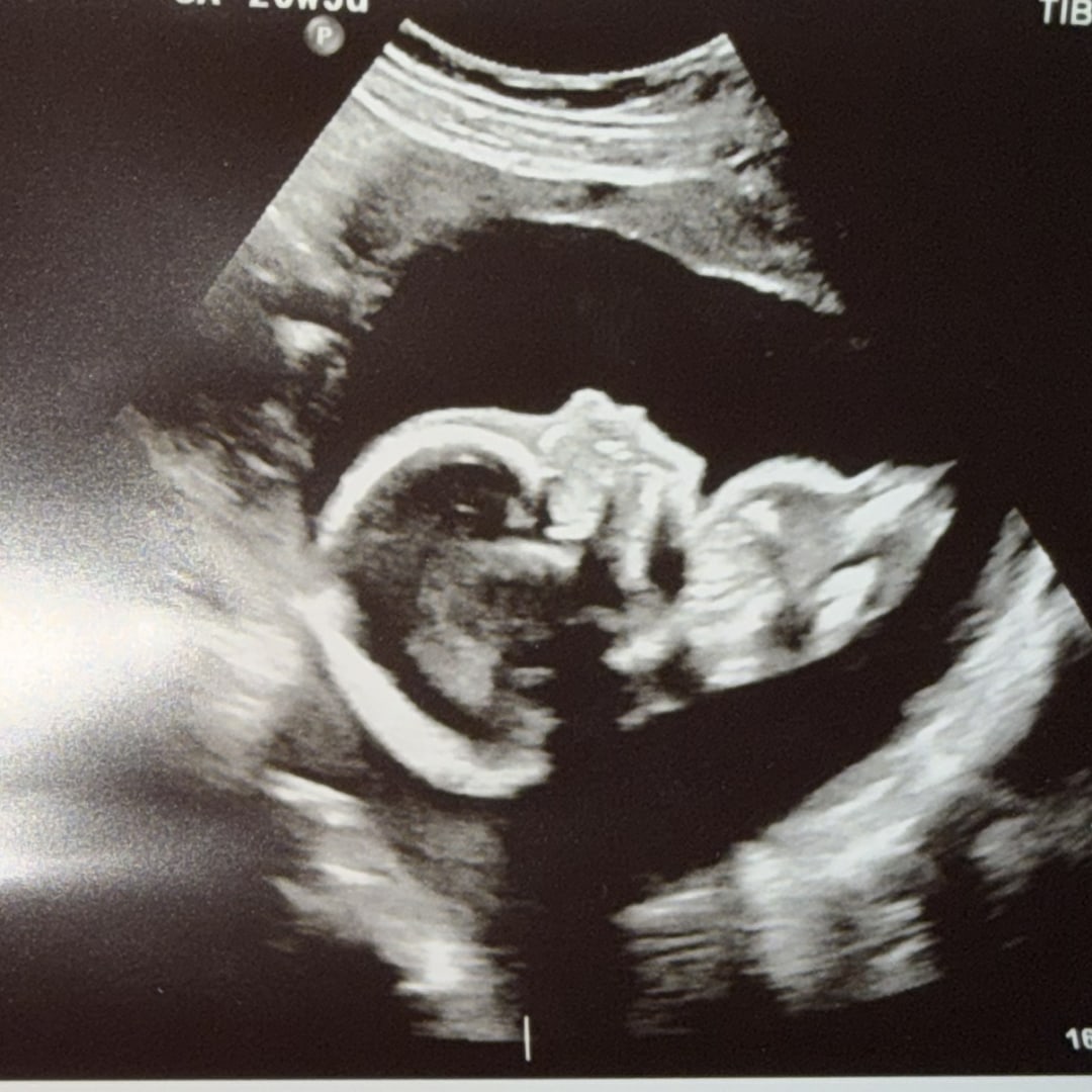 Photo shared by Ashley for their Babylist baby registry.