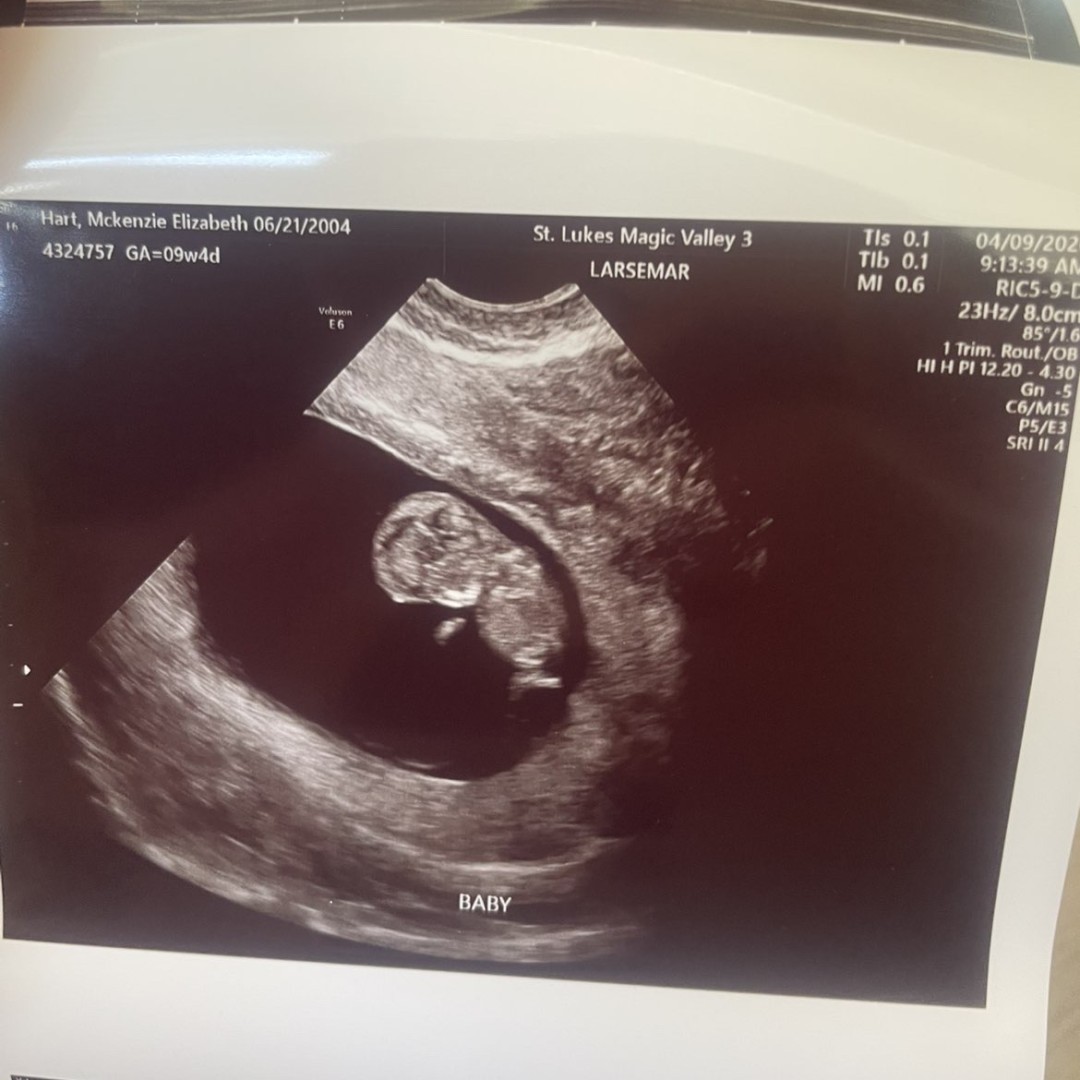 Photo shared by Mckenzie for their Babylist baby registry.