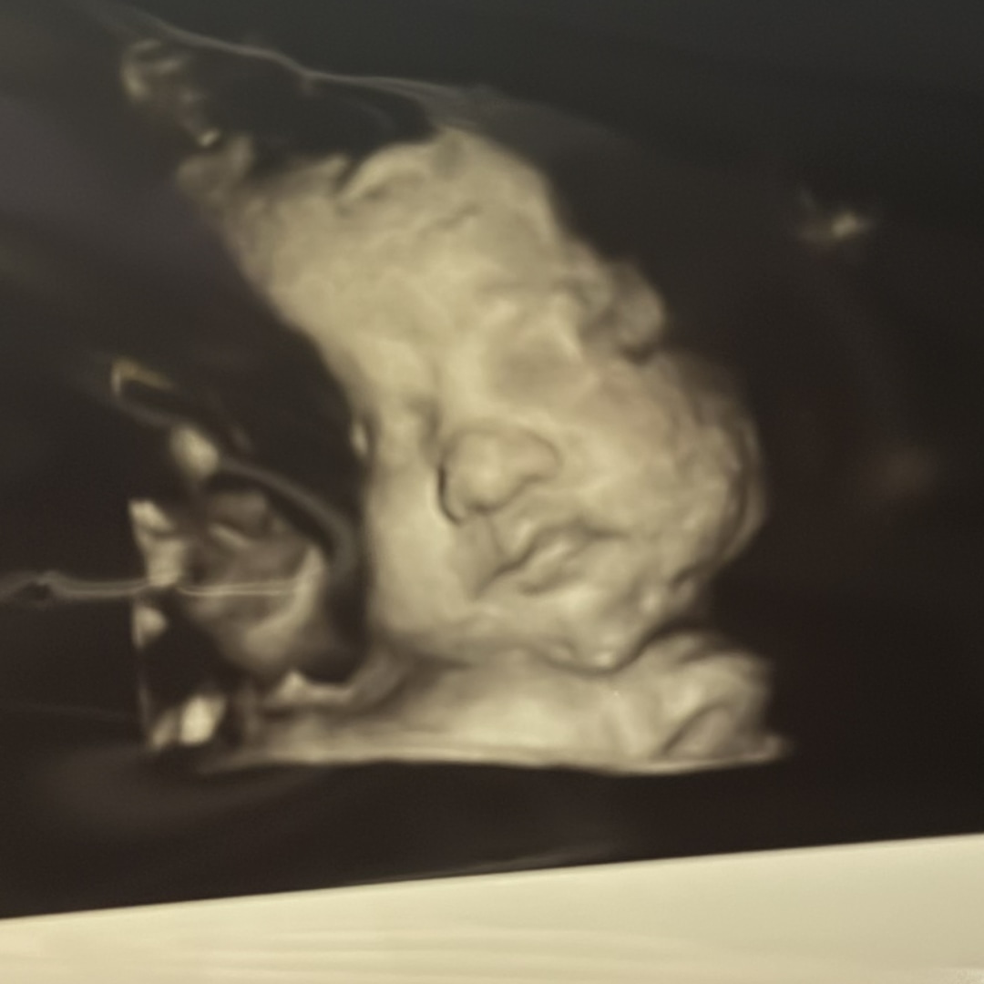 Photo shared by Khya for their Babylist baby registry.