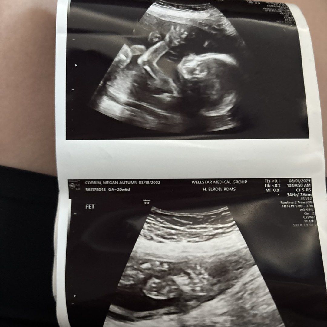 Photo shared by Megan for their Babylist baby registry.