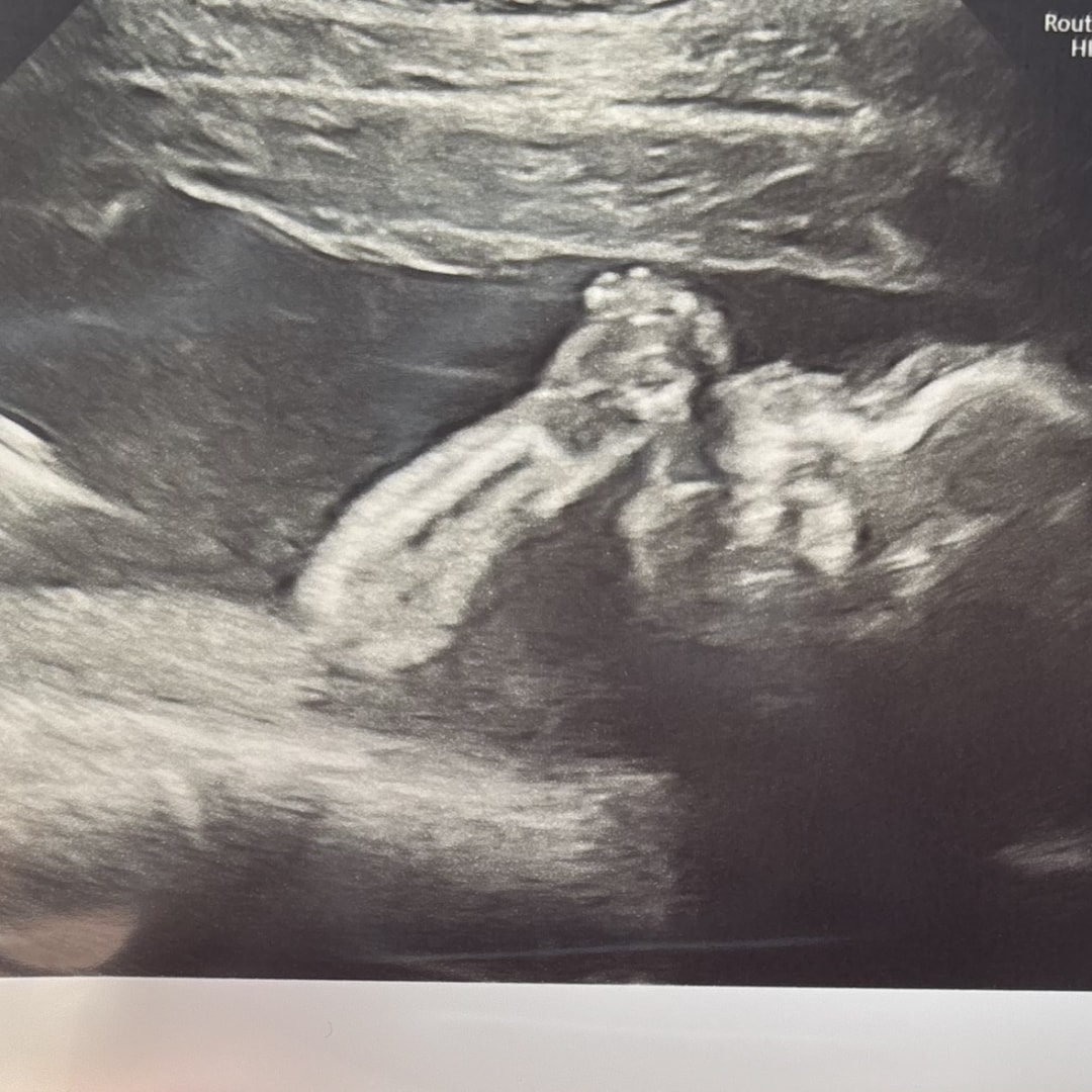 Photo shared by Katherine for their Babylist baby registry.