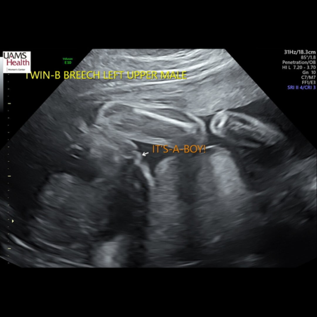 Photo shared by Cammy for their Babylist baby registry.