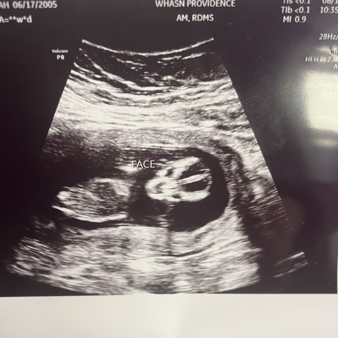 Photo shared by Aiden for their Babylist baby registry.