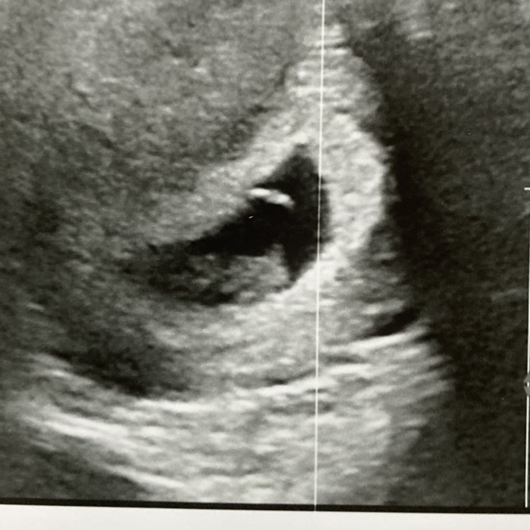 Photo shared by Magan for their Babylist baby registry.