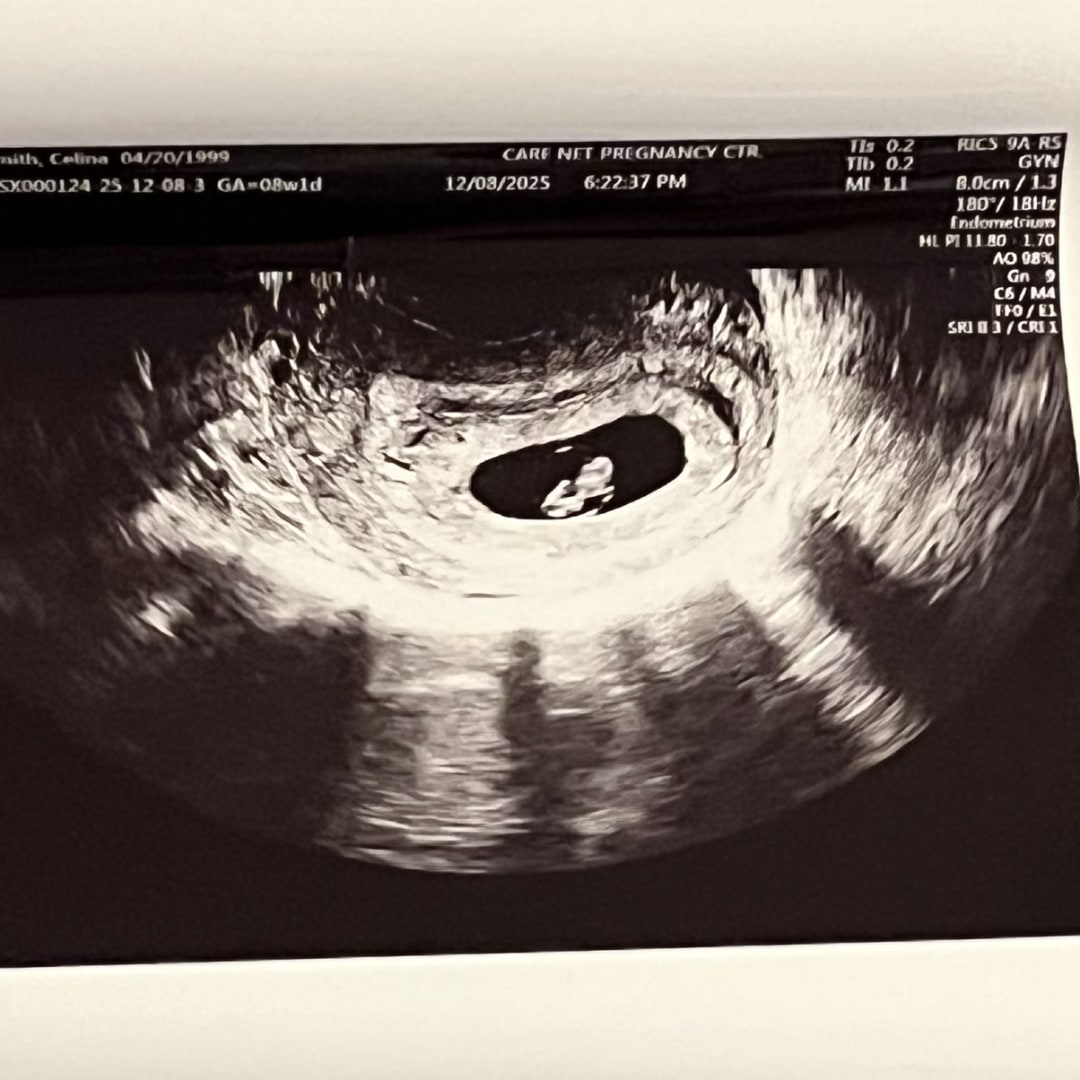 Photo shared by Celina for their Babylist baby registry.