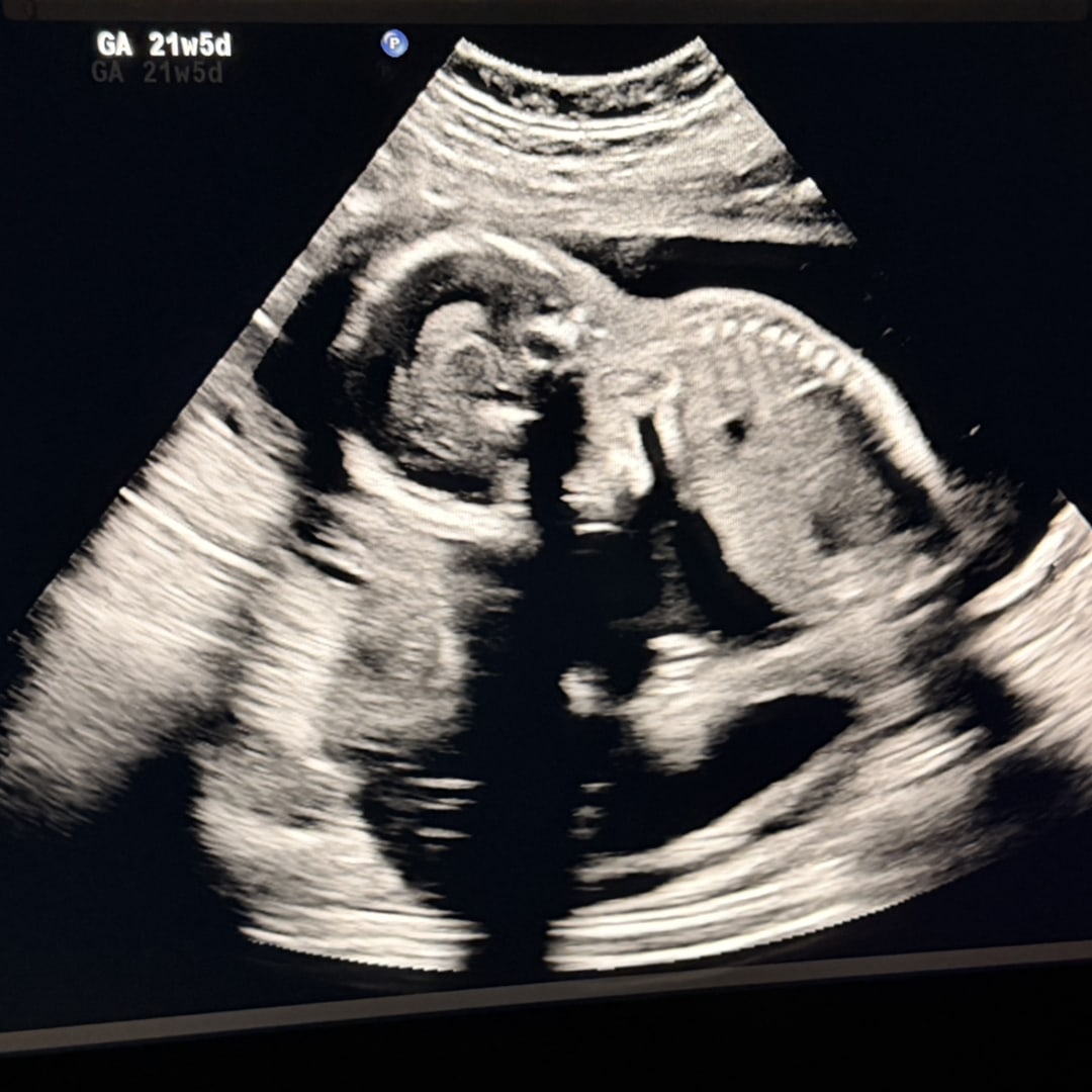 Photo shared by Celestina for their Babylist baby registry.