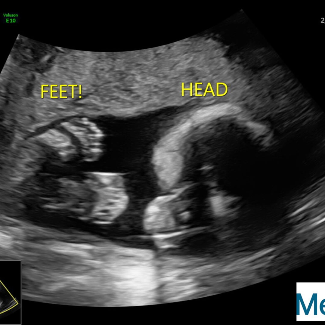 Photo shared by Edisa for their Babylist baby registry.