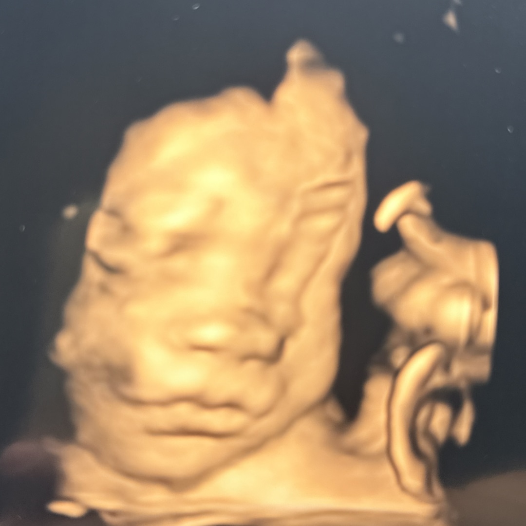 Photo shared by Emily for their Babylist baby registry.
