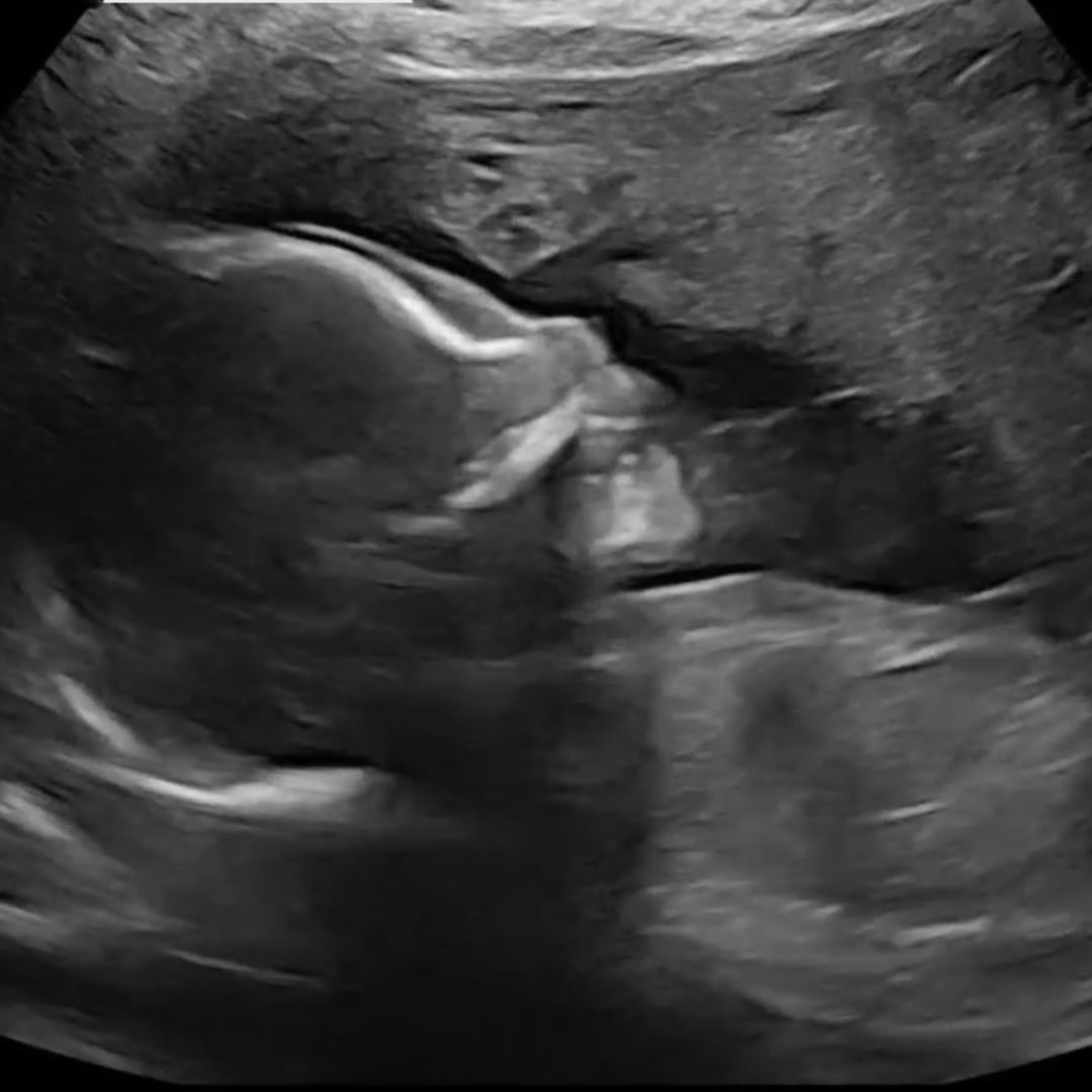 Photo shared by Corrina for their Babylist baby registry.