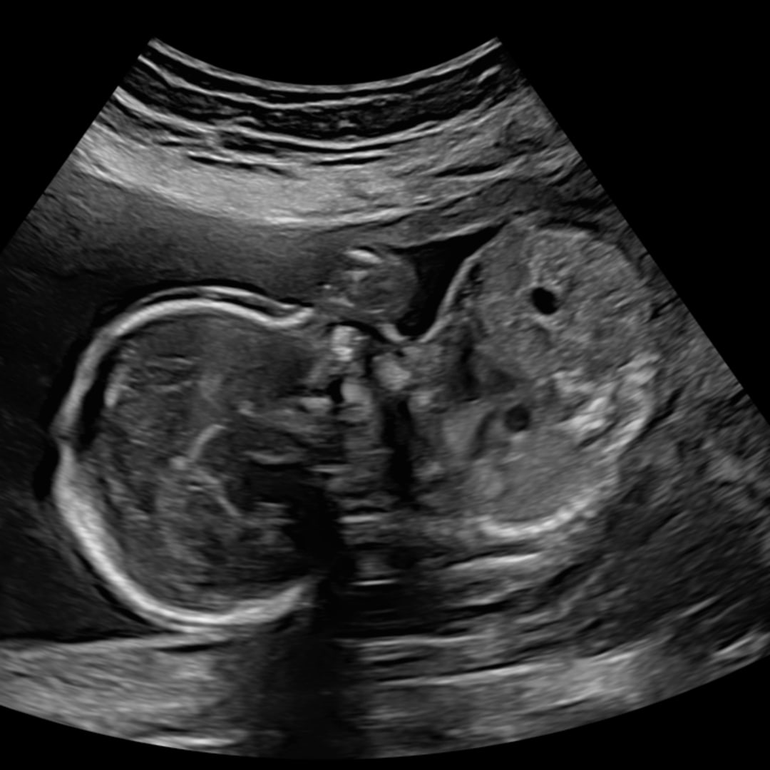Photo shared by Alejandra for their Babylist baby registry.