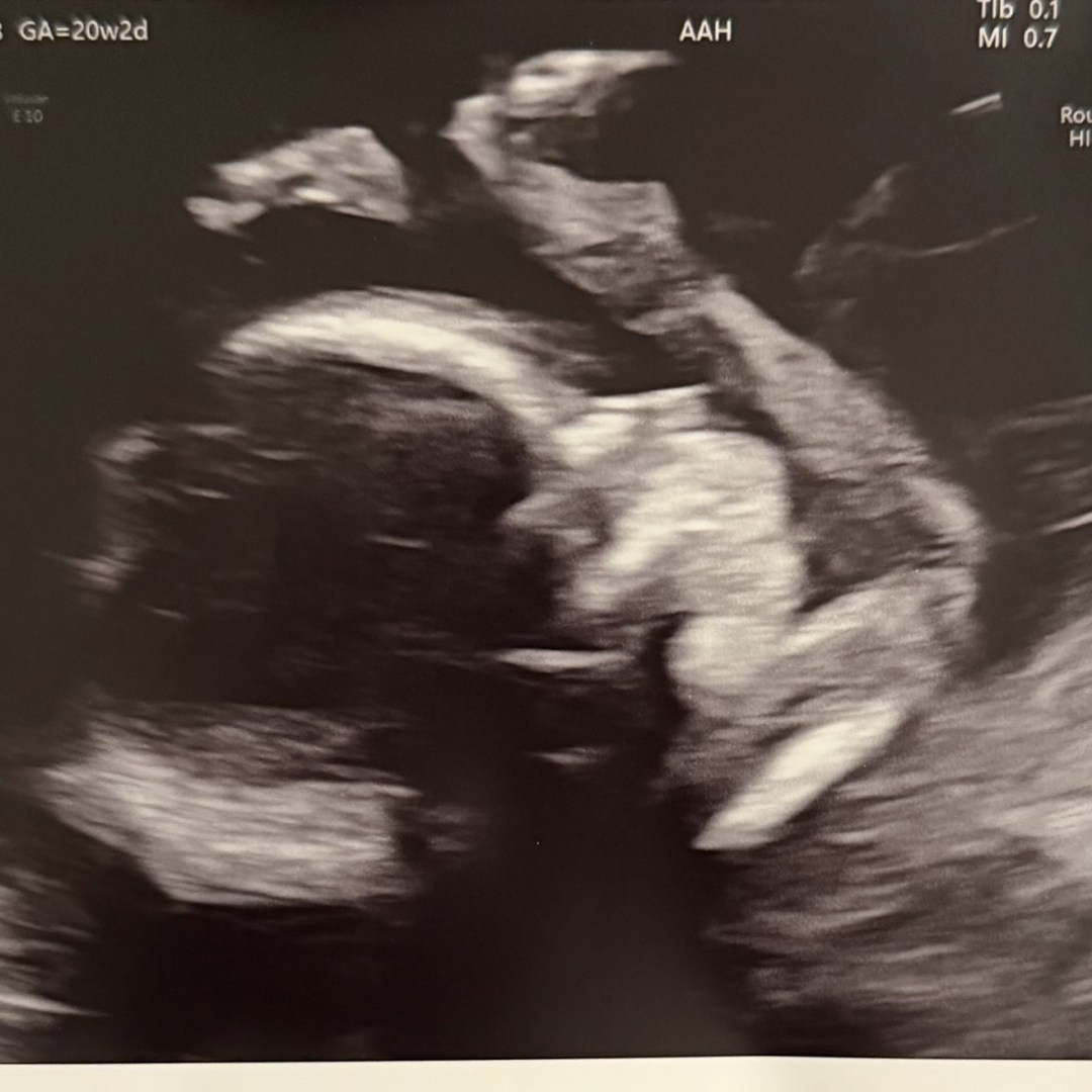 Photo shared by Christine for their Babylist baby registry.