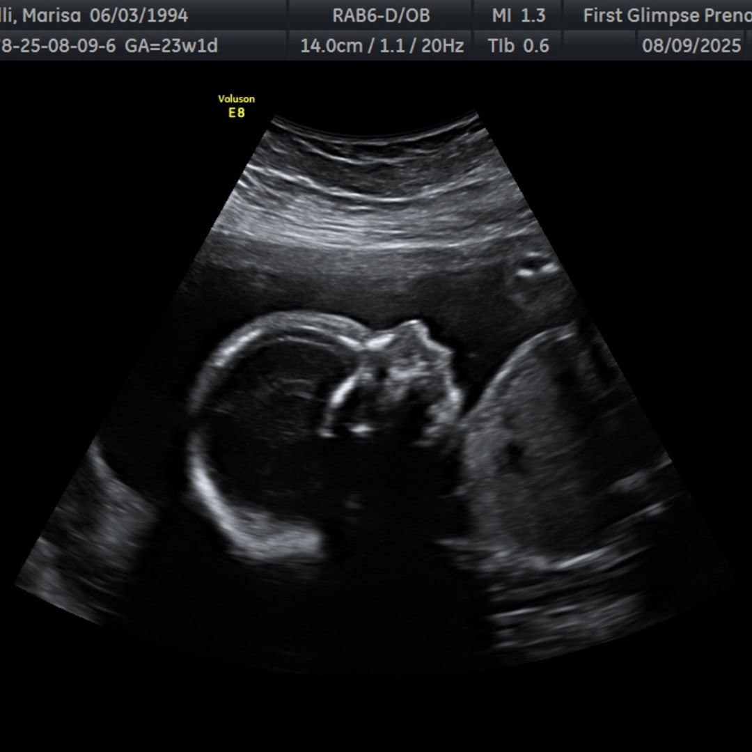 Photo shared by Marisa for their Babylist baby registry.