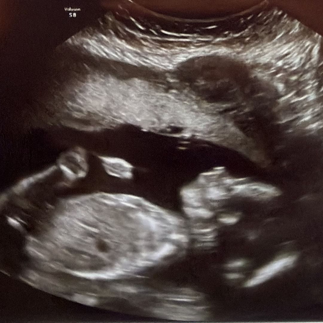 Photo shared by Ashleigh for their Babylist baby registry.