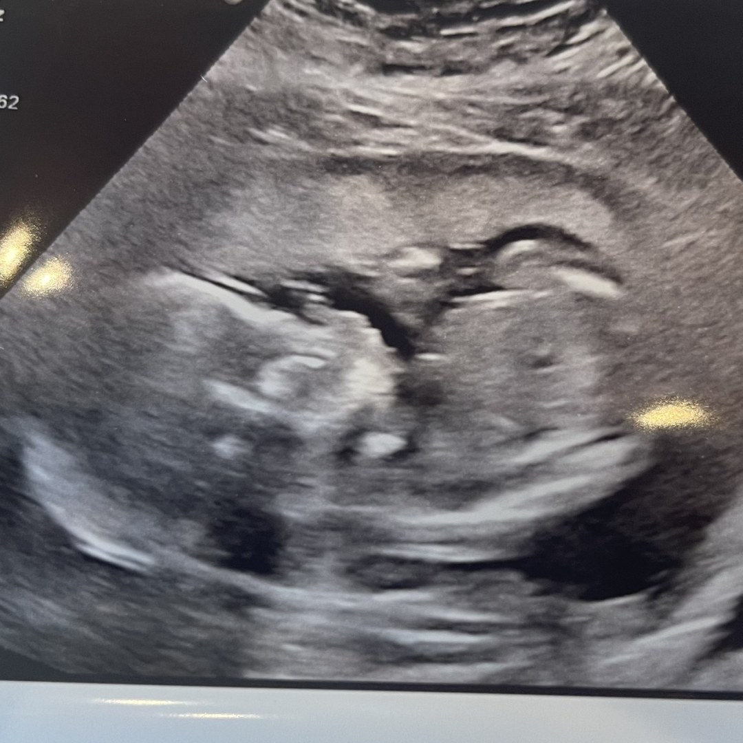Photo shared by Tyra for their Babylist baby registry.