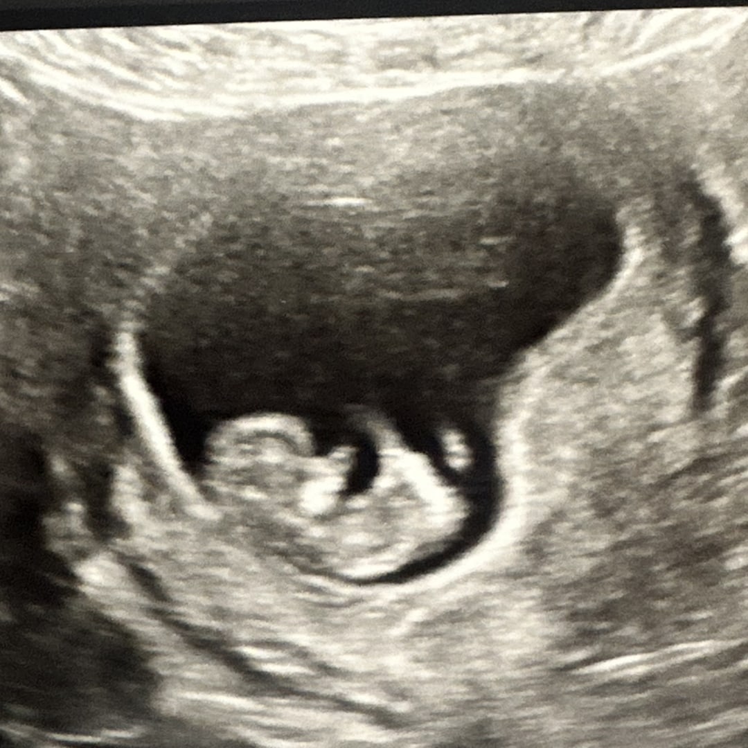 Photo shared by Mary for their Babylist baby registry.