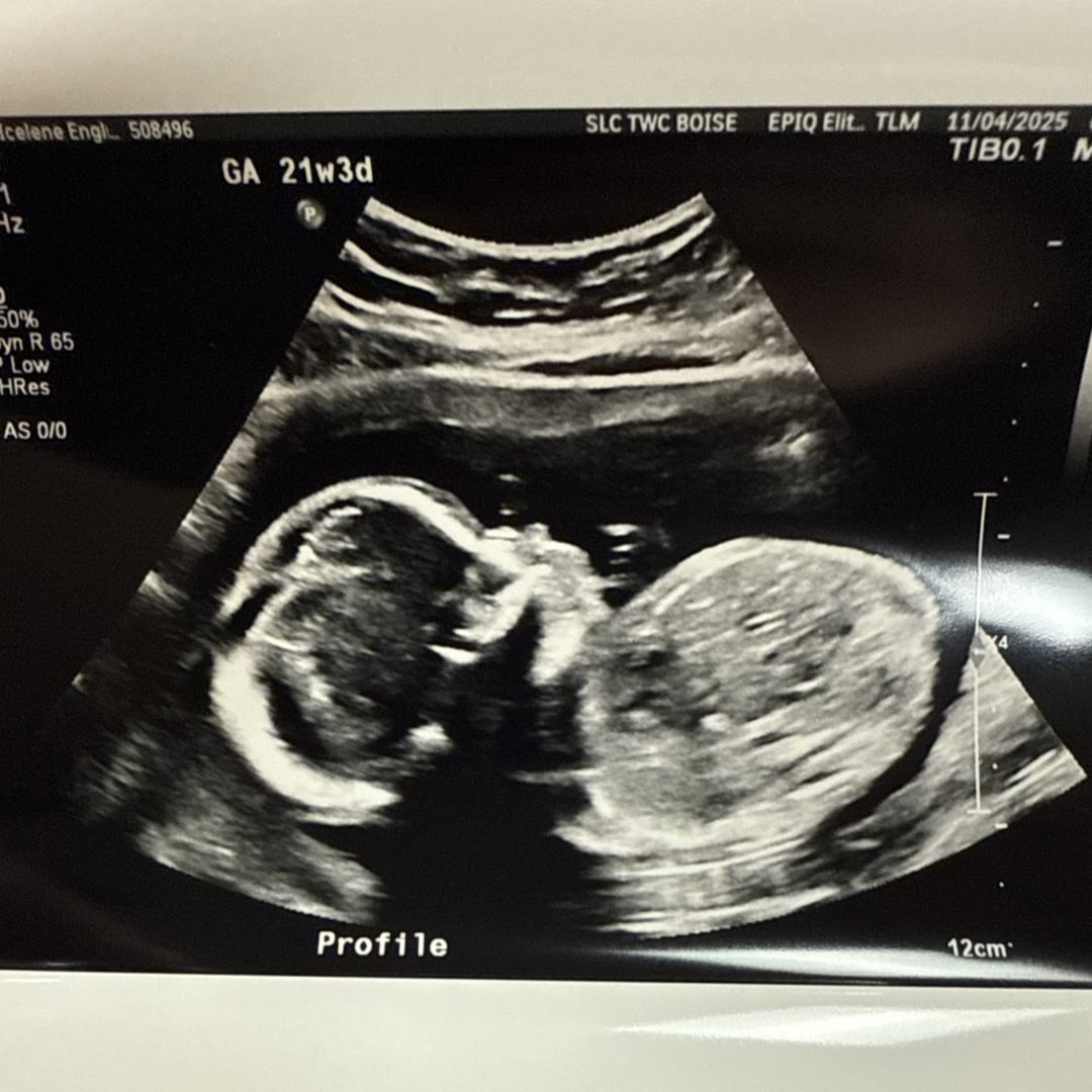 Photo shared by Icelene for their Babylist baby registry.