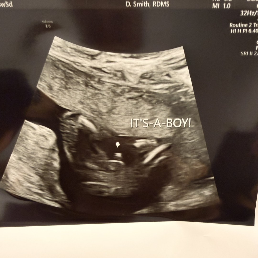 Photo shared by Emily for their Babylist baby registry.