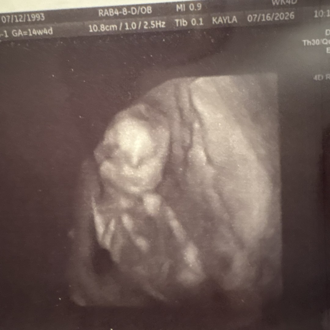 Photo shared by Elizabeth for their Babylist baby registry.