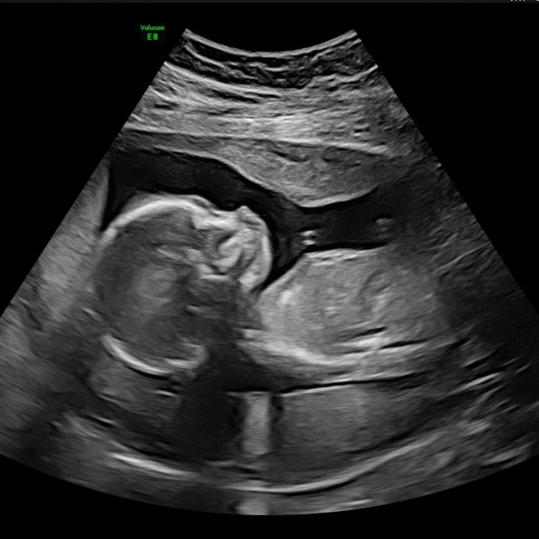 Photo shared by Hannah for their Babylist baby registry.