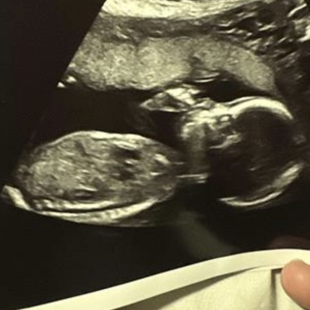 Photo shared by Emily for their Babylist baby registry.