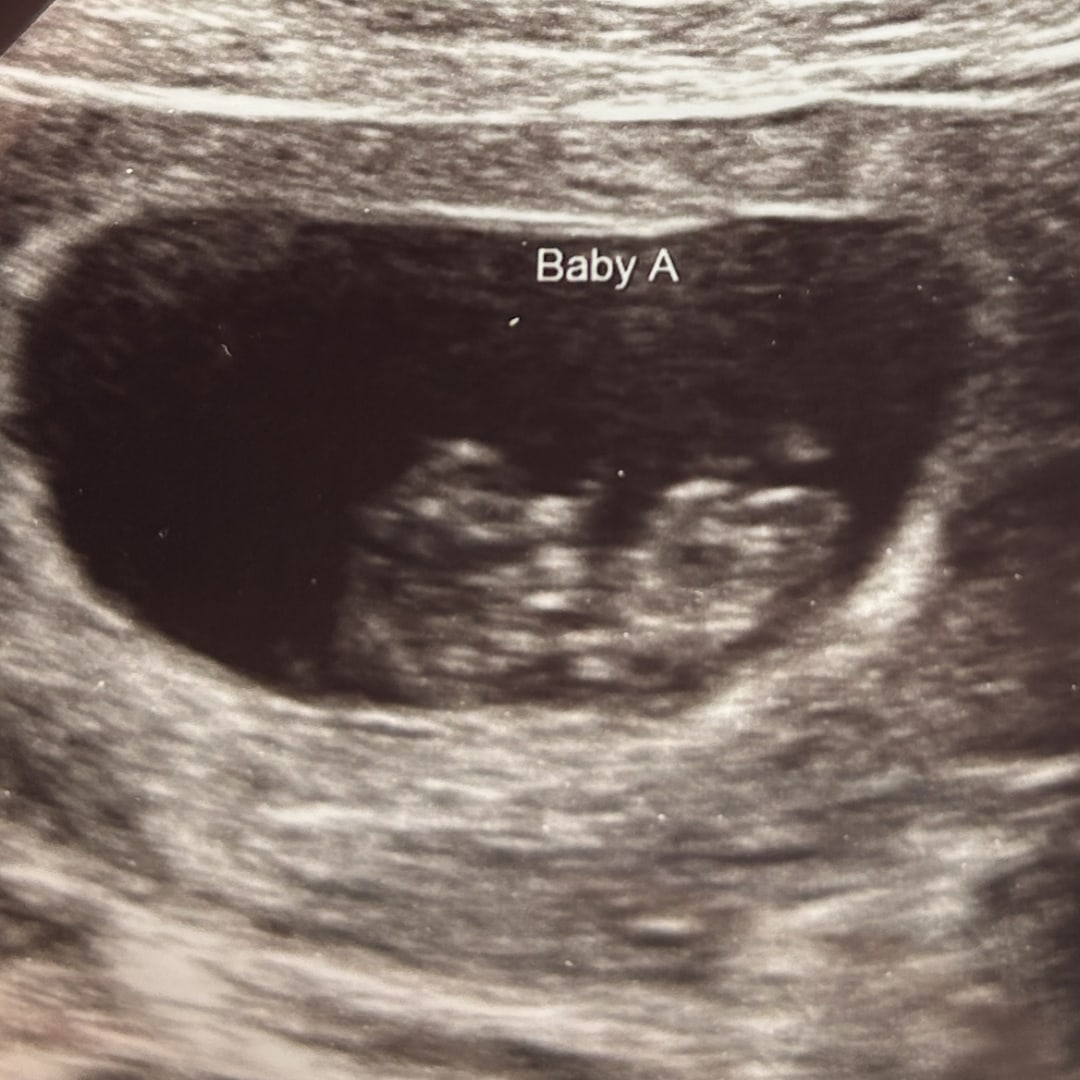 Photo shared by Rachelle for their Babylist baby registry.