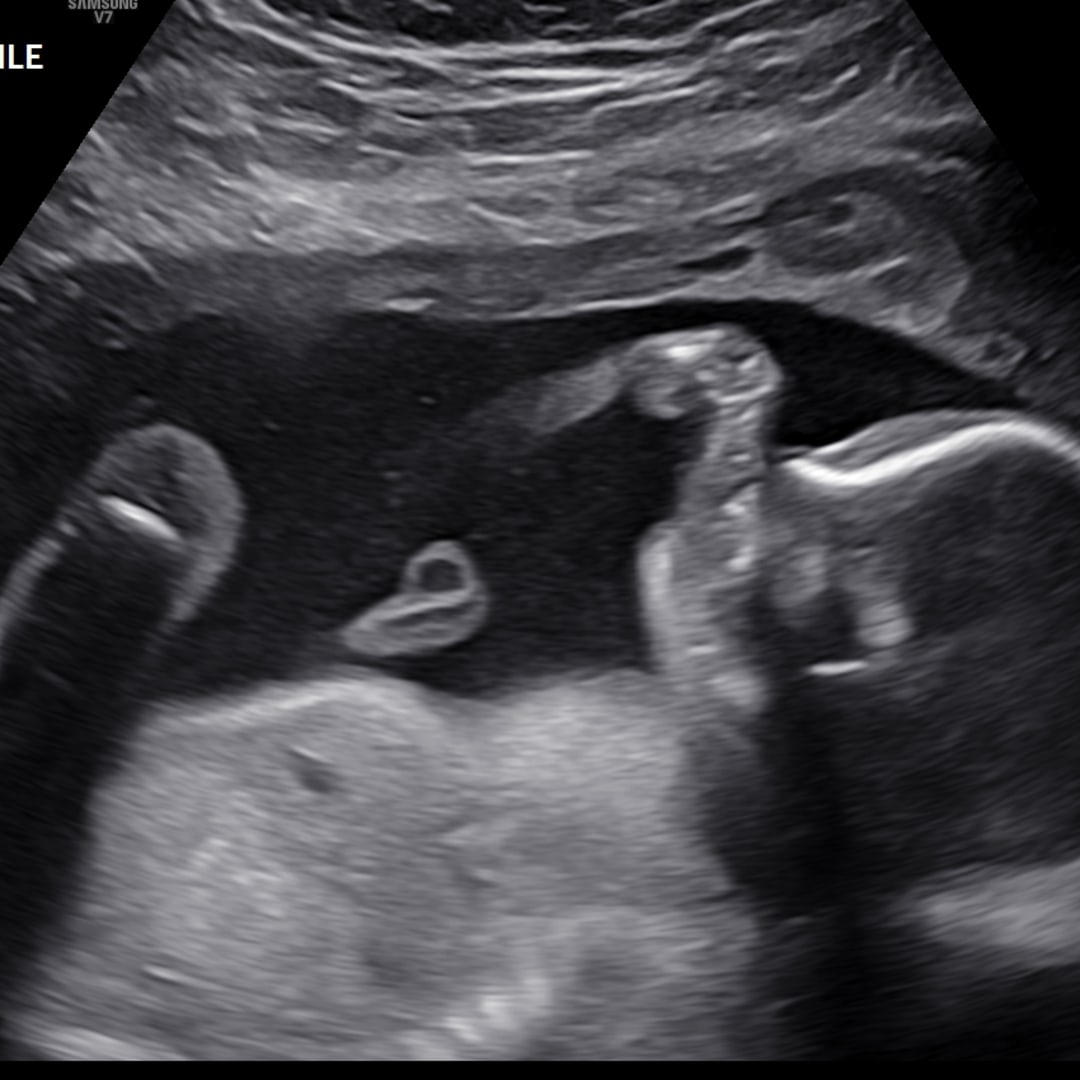 Photo shared by Rachael for their Babylist baby registry.