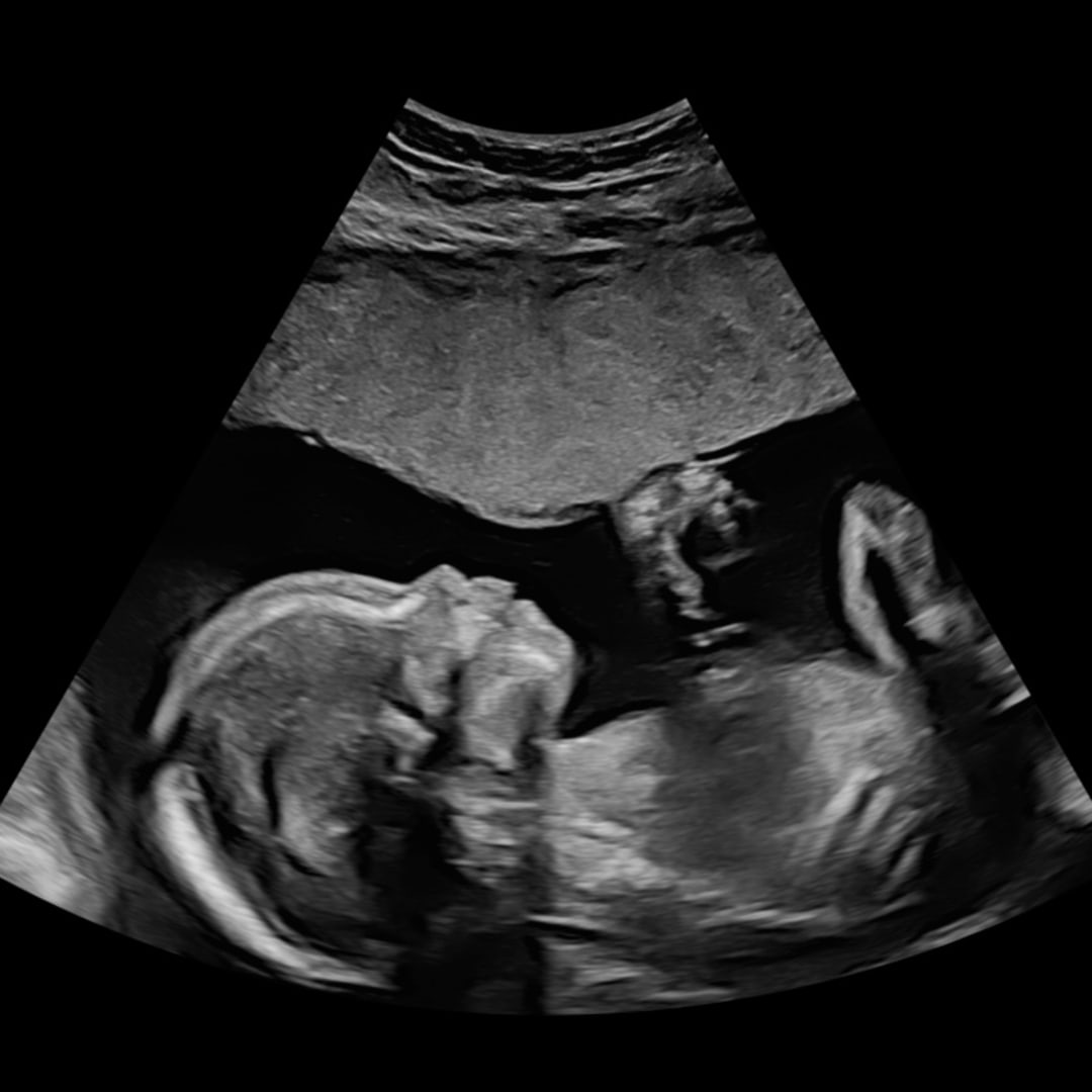 Photo shared by Ashley for their Babylist baby registry.