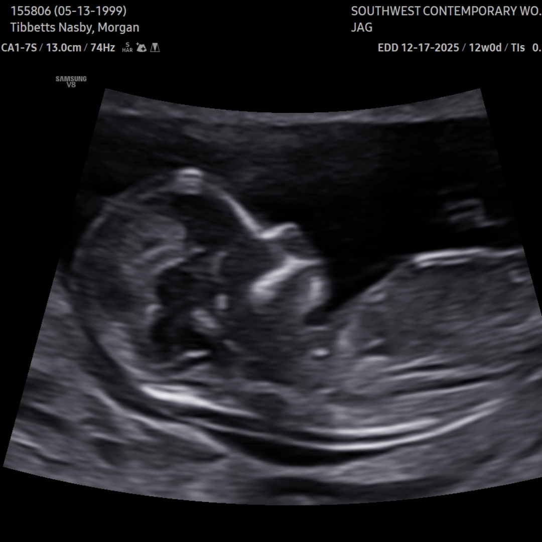 Photo shared by Morgan for their Babylist baby registry.