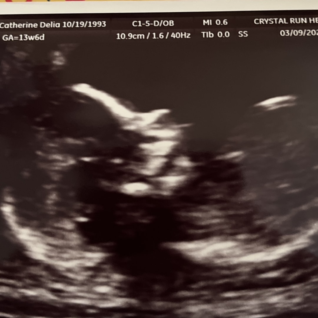 Photo shared by Cate for their Babylist baby registry.