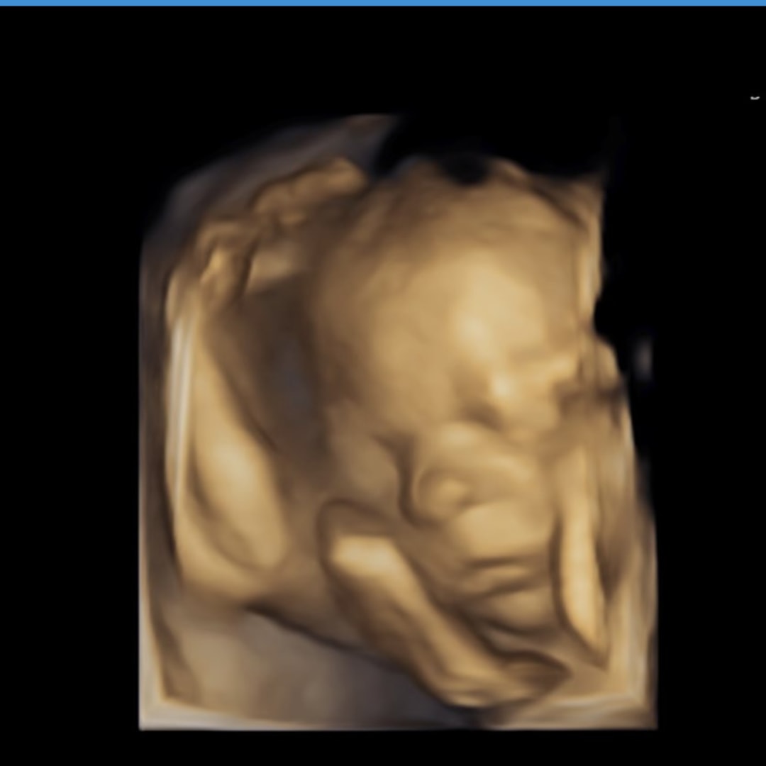 Photo shared by Emily for their Babylist baby registry.