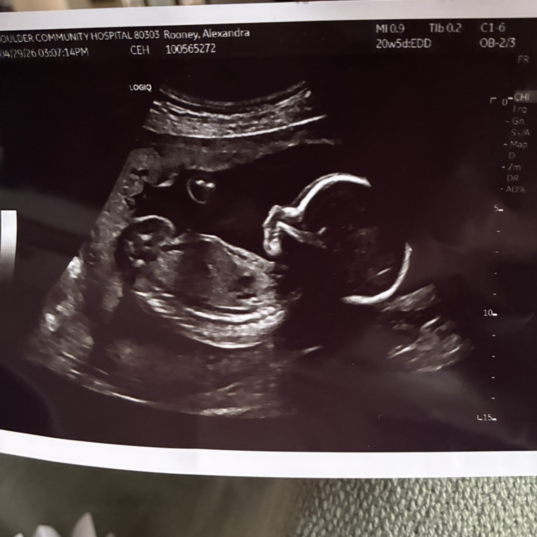 Photo shared by Alex May for their Babylist baby registry.