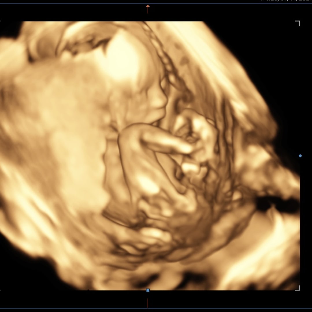Photo shared by Ally for their Babylist baby registry.