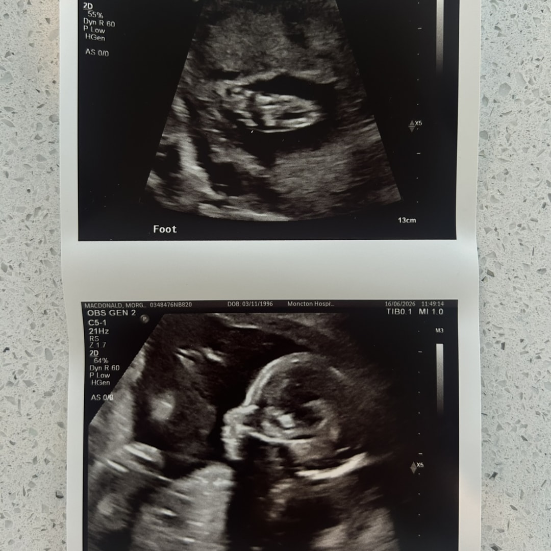 Photo shared by Morgan for their Babylist baby registry.