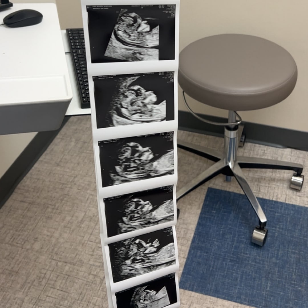 Photo shared by Ashley for their Babylist baby registry.