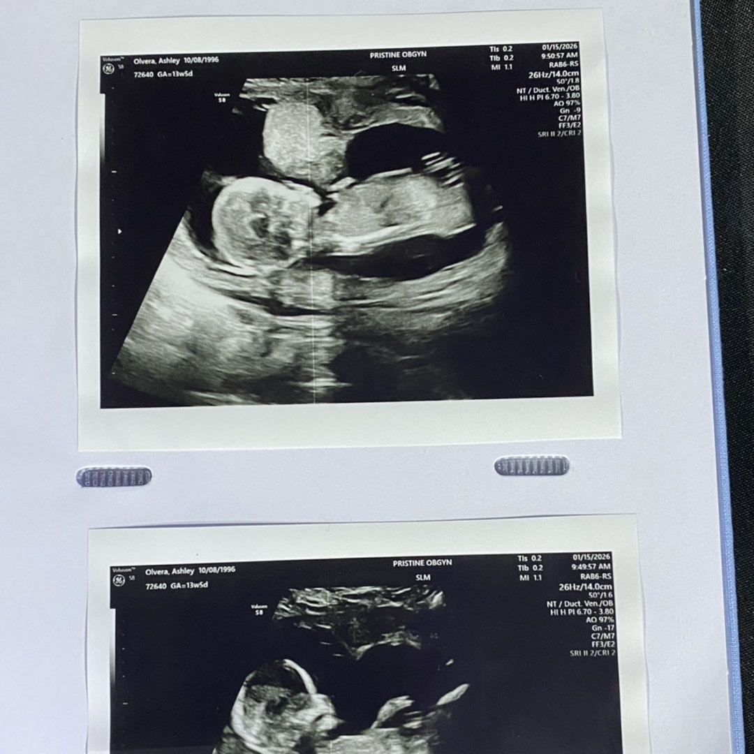 Photo shared by Ashley for their Babylist baby registry.