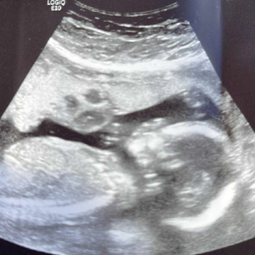 Photo shared by Shea for their Babylist baby registry.