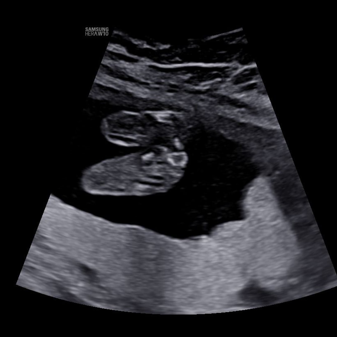 Photo shared by Addison for their Babylist baby registry.