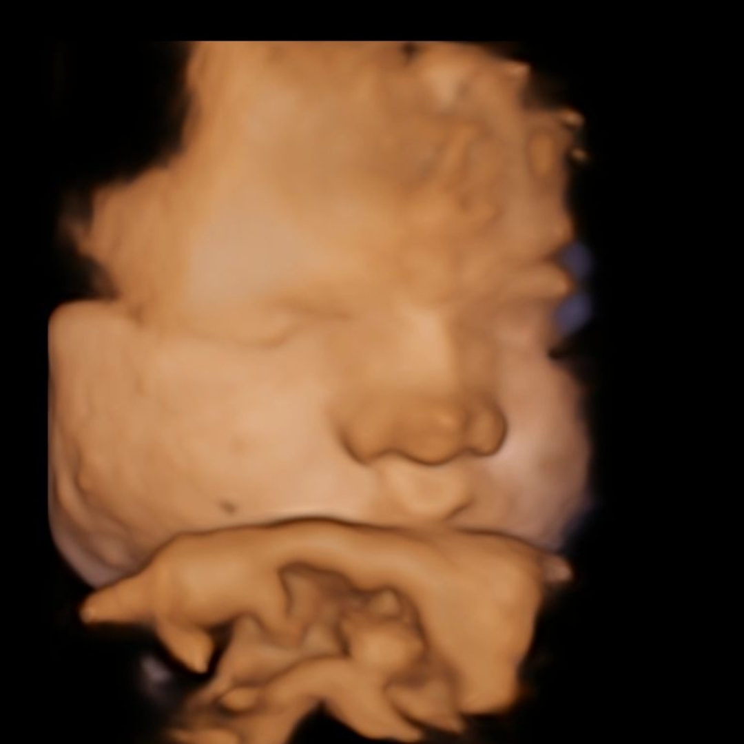 Photo shared by Nadja for their Babylist baby registry.