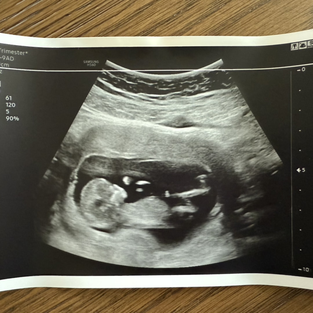 Photo shared by Allison for their Babylist baby registry.