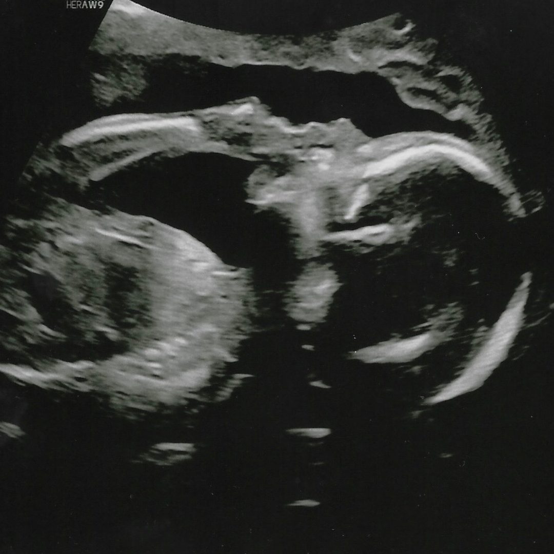 Photo shared by Ellen for their Babylist baby registry.
