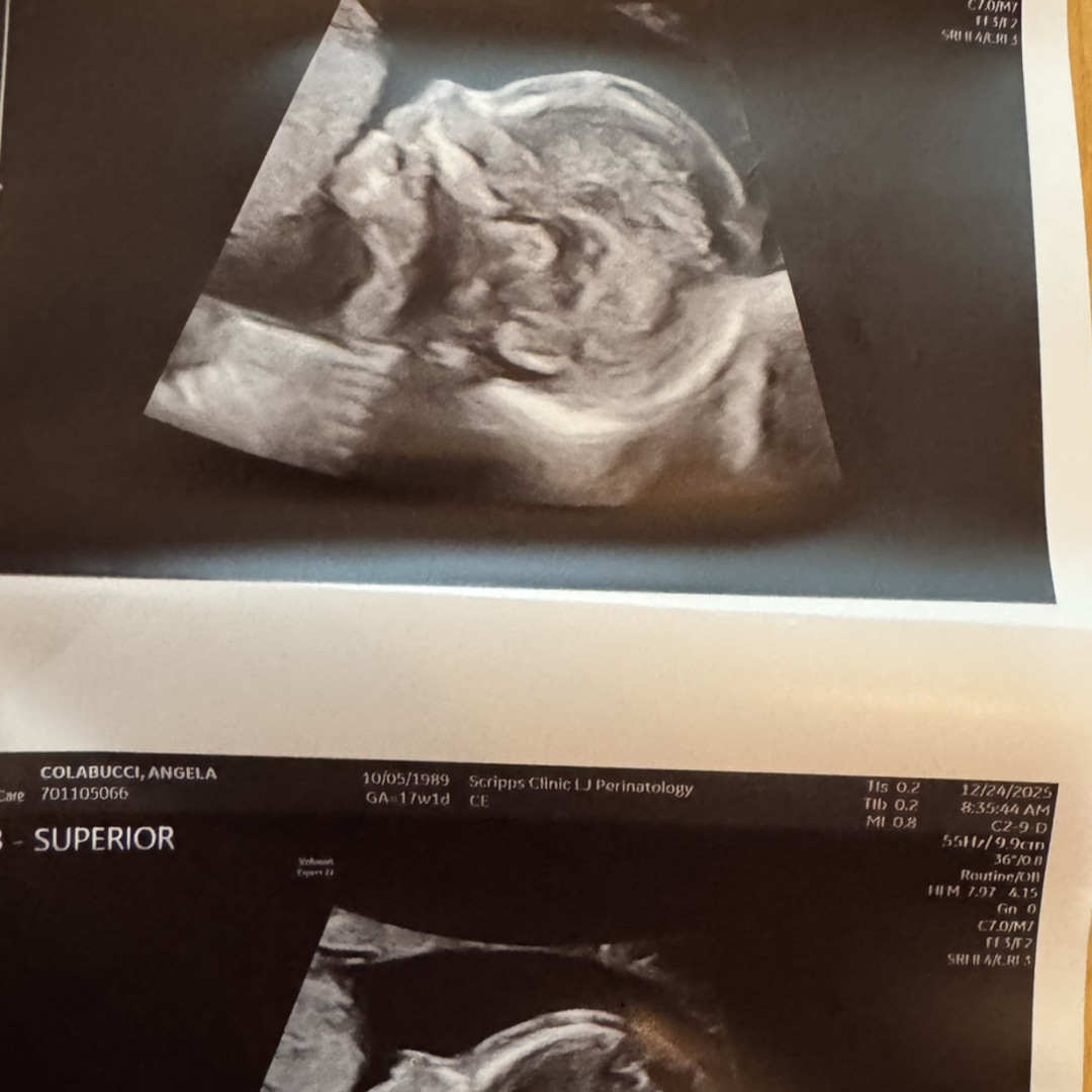 Photo shared by Kyle for their Babylist baby registry.