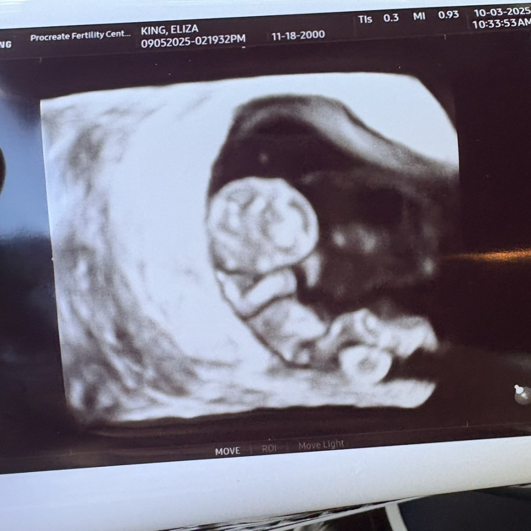 Photo shared by Eliza for their Babylist baby registry.