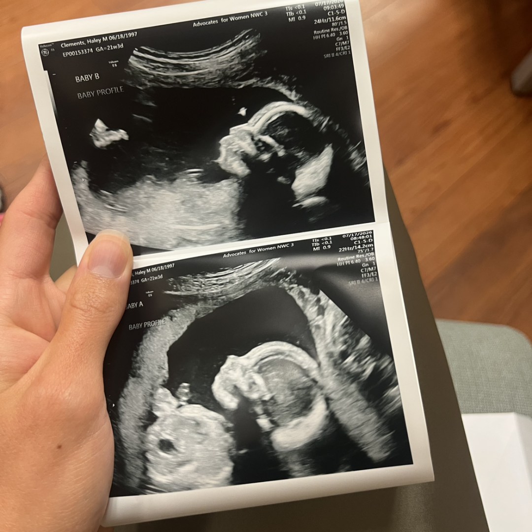 Photo shared by Haley for their Babylist baby registry.