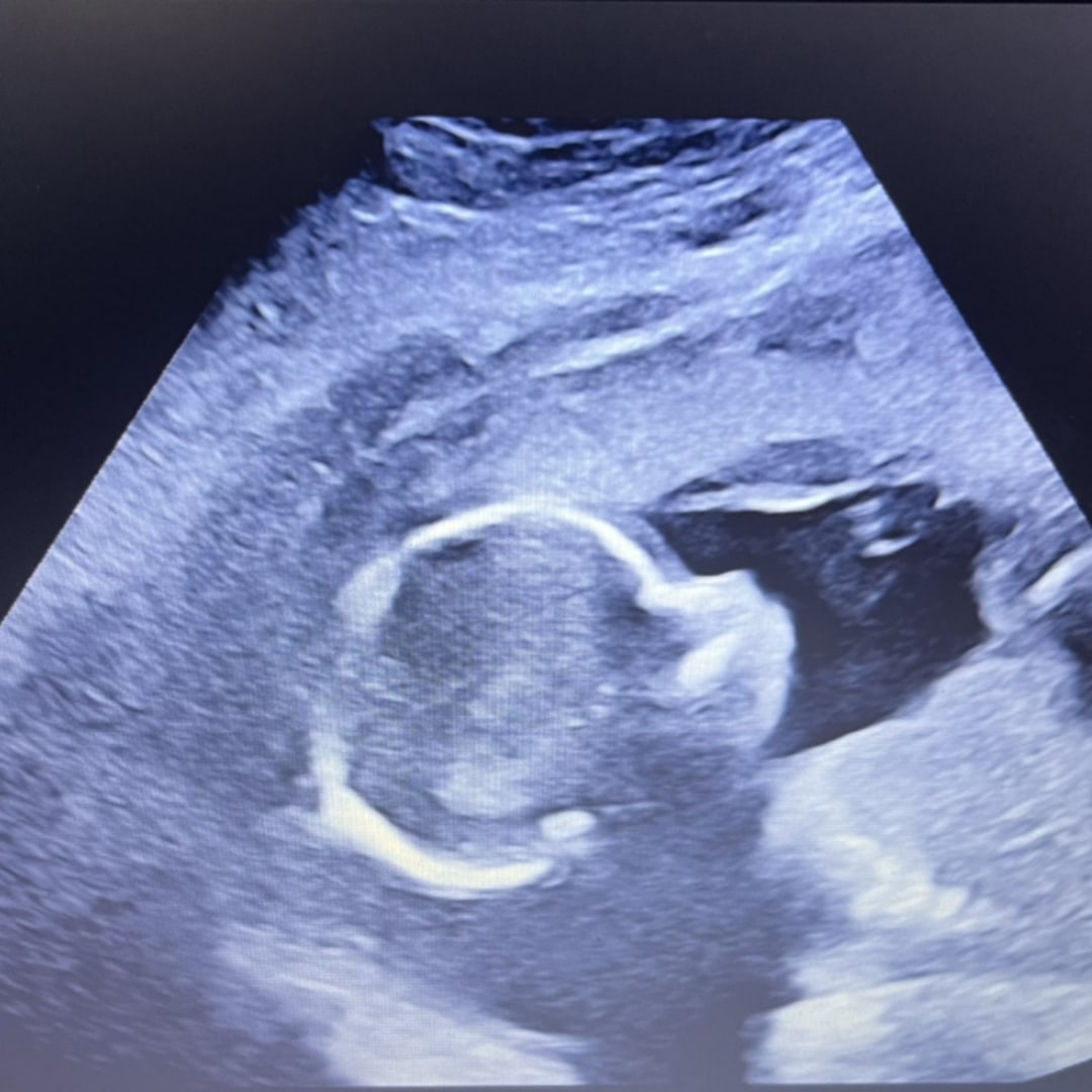 Photo shared by Ashley for their Babylist baby registry.